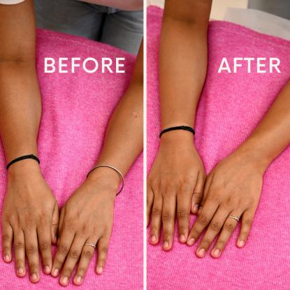 Elite Skin Centre - Skin Clinic in Lucknow